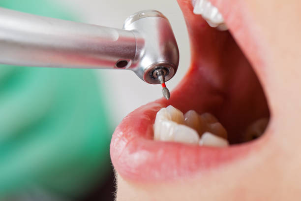Best Emergency Broken Tooth Repair in Highland, AR